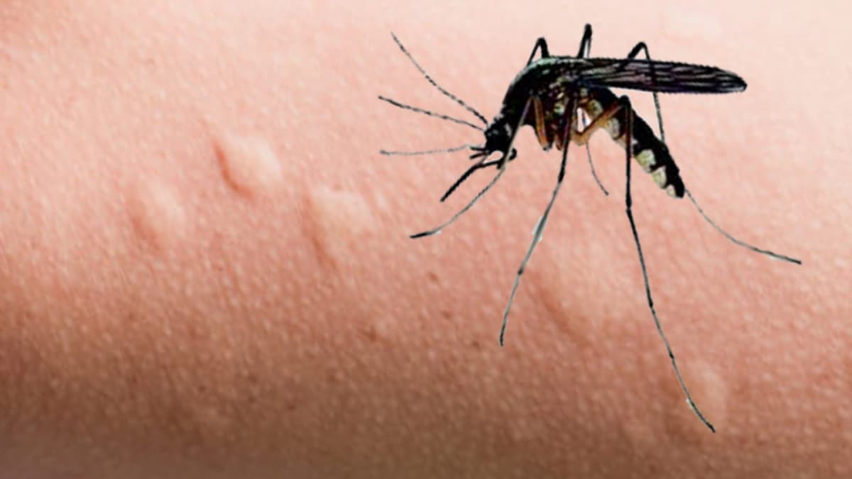 Moustique et aspect de sa piqûre